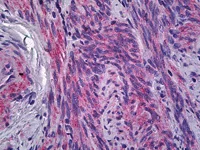 Immunohistochemistry (Formalin/PFA-fixed paraffin-embedded sections) - Anti-IFITM1 antibody (AB117533)