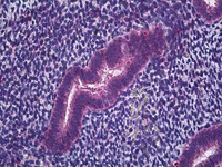 Immunohistochemistry (Formalin/PFA-fixed paraffin-embedded sections) - Anti-IFITM1 antibody (AB117533)