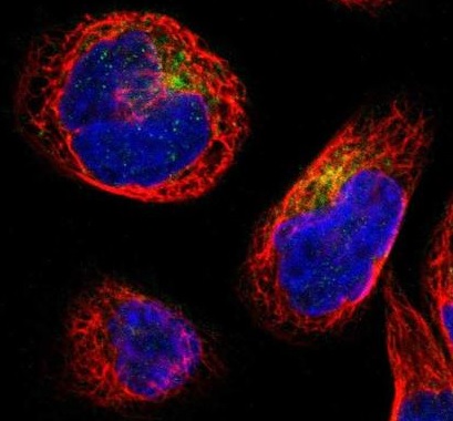 Immunocytochemistry/ Immunofluorescence - Anti-IFITM1 antibody (AB224063)