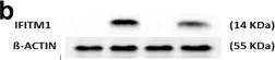 Western blot - Anti-IFITM1 antibody (AB224063)
