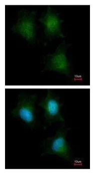 Immunocytochemistry/ Immunofluorescence - Anti-IFITM1 antibody (AB272861)