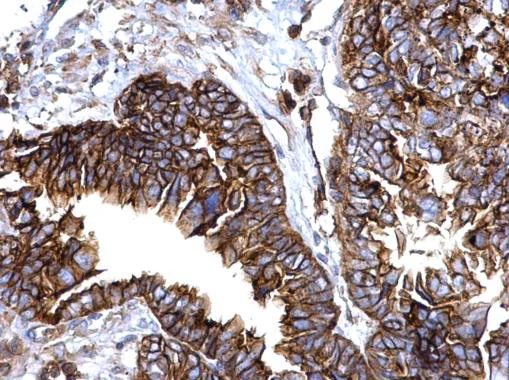 Immunohistochemistry (Formalin/PFA-fixed paraffin-embedded sections) - Anti-IFITM1 antibody (AB272861)
