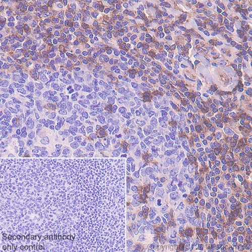 Immunohistochemistry (Formalin/PFA-fixed paraffin-embedded sections) - Anti-IFITM1 antibody [EPR22620-12] (AB233545), expandable thumbnail