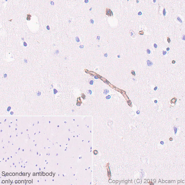 Immunohistochemistry (Formalin/PFA-fixed paraffin-embedded sections) - Anti-IFITM1 antibody [EPR22620-12] (AB233545)