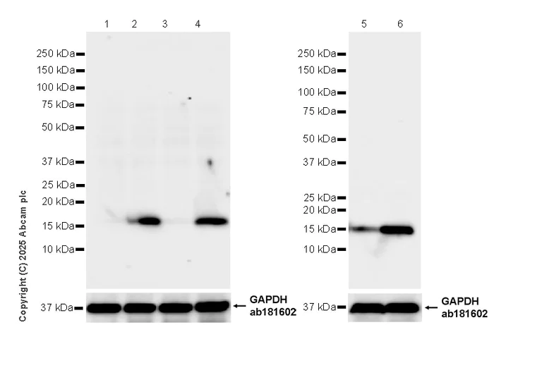 Western blot - Anti-IFITM2+IFITM3 antibody [EPR28942-88] (AB323747)