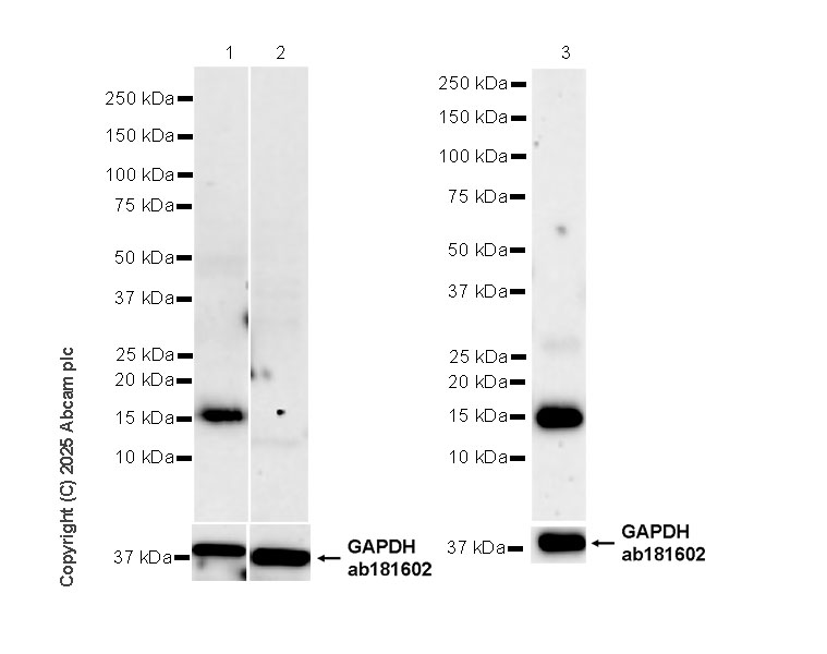 Western blot - Anti-IFITM2+IFITM3 antibody [EPR28942-88] (ab323747), expandable thumbnail