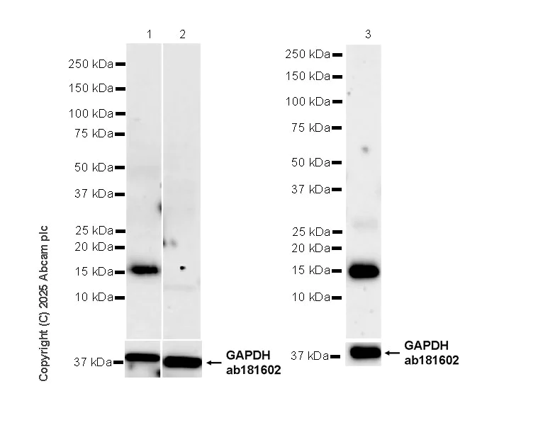 Western blot - Anti-IFITM2+IFITM3 antibody [EPR28942-88] (AB323747)