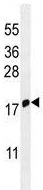 Western blot - Anti-IFITM5 antibody (AB230863), expandable thumbnail