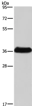 Western blot - Anti-IFN gamma Receptor beta/AF-1 antibody (AB198801)