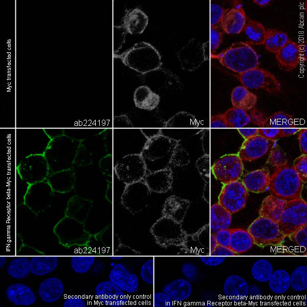 Immunocytochemistry/ Immunofluorescence - Anti-IFN gamma Receptor beta/AF-1 antibody [EPR22171] - BSA and Azide free (AB240559)