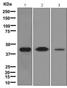 Western blot - Anti-IFN gamma Receptor beta/AF-1 antibody [EPR8813] - BSA and Azide free (AB249636), expandable thumbnail