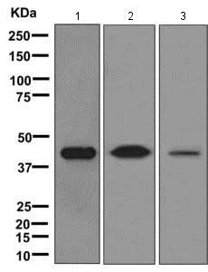Western blot - Anti-IFN gamma Receptor beta/AF-1 antibody [EPR8813] - BSA and Azide free (AB249636)