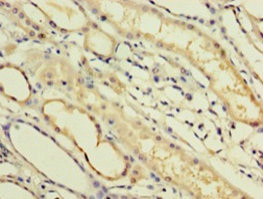 Immunohistochemistry (Formalin/PFA-fixed paraffin-embedded sections) - Anti-IFNA14 antibody (AB235515)