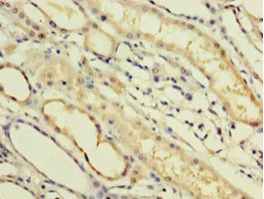 Immunohistochemistry (Formalin/PFA-fixed paraffin-embedded sections) - Anti-IFNA14 antibody (AB235515)
