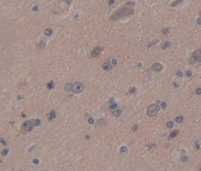 Immunohistochemistry (Formalin/PFA-fixed paraffin-embedded sections) - Anti-IFNA4 antibody (AB232899), expandable thumbnail