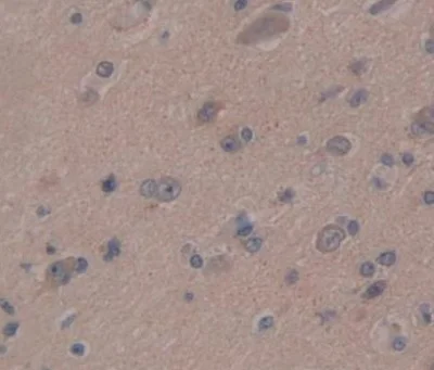 Immunohistochemistry (Formalin/PFA-fixed paraffin-embedded sections) - Anti-IFNA4 antibody (AB232899)