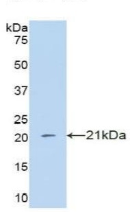 Western blot - Anti-IFNA4 antibody (AB232899), expandable thumbnail