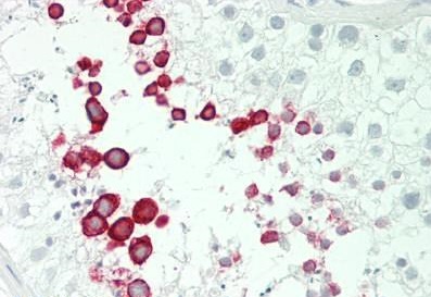 Immunohistochemistry (Formalin/PFA-fixed paraffin-embedded sections) - Anti-IFNA4 antibody - C-terminal (AB230843)
