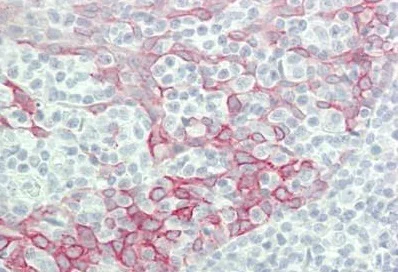 Immunohistochemistry (Formalin/PFA-fixed paraffin-embedded sections) - Anti-IFNA4 antibody - C-terminal (AB230843)