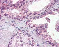 Immunohistochemistry (Formalin/PFA-fixed paraffin-embedded sections) - Anti-IFNAR2 antibody (AB104451)