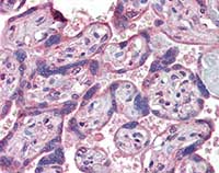 Immunohistochemistry (Formalin/PFA-fixed paraffin-embedded sections) - Anti-IFNAR2 antibody (AB104451)