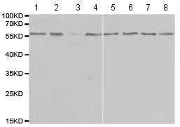Western blot - Anti-IFNAR2 antibody (AB193410)