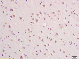 Immunohistochemistry (Formalin/PFA-fixed paraffin-embedded sections) - Anti-IFNAR2 antibody (AB204126)