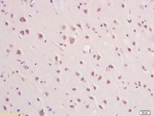 Immunohistochemistry (Formalin/PFA-fixed paraffin-embedded sections) - Anti-IFNAR2 antibody (AB204126)