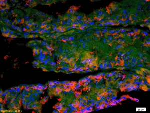 Immunohistochemistry (Formalin/PFA-fixed paraffin-embedded sections) - Anti-IFNAR2 antibody (AB204126)