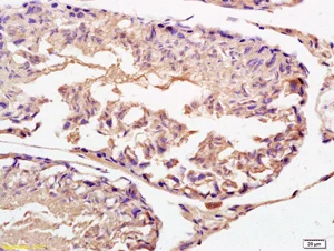 Immunohistochemistry (Formalin/PFA-fixed paraffin-embedded sections) - Anti-IFNAR2 antibody (AB204126)