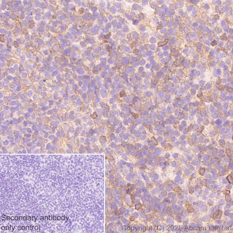 Immunohistochemistry (Formalin/PFA-fixed paraffin-embedded sections) - Anti-IFNAR2 antibody [EPR30040-606] (AB325344)