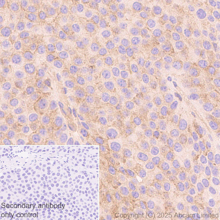 Immunohistochemistry (Formalin/PFA-fixed paraffin-embedded sections) - Anti-IFNAR2 antibody [EPR30040-606] (AB325344)