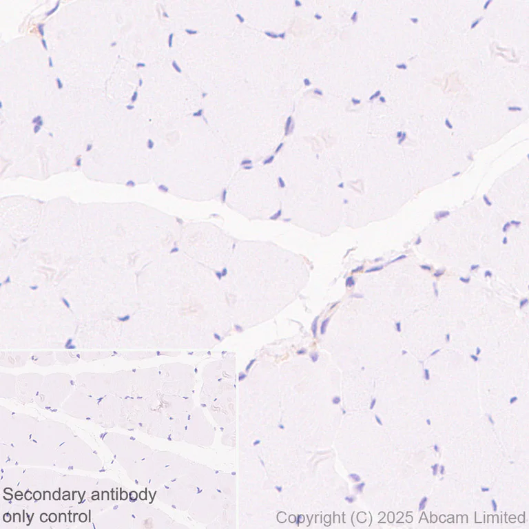 Immunohistochemistry (Formalin/PFA-fixed paraffin-embedded sections) - Anti-IFNAR2 antibody [EPR30040-606] (AB325344)