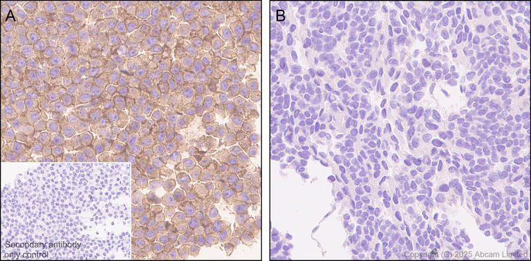 Immunohistochemistry (Formalin/PFA-fixed paraffin-embedded sections) - Anti-IFNAR2 antibody [EPR30040-606] (AB325344)