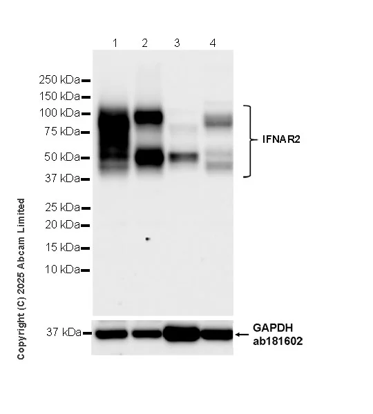 Western blot - Anti-IFNAR2 antibody [EPR30040-606] (AB325344)
