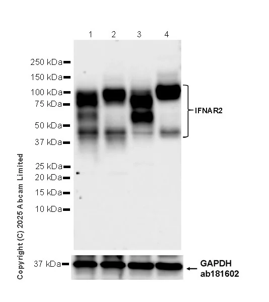 Western blot - Anti-IFNAR2 antibody [EPR30040-606] (AB325344)