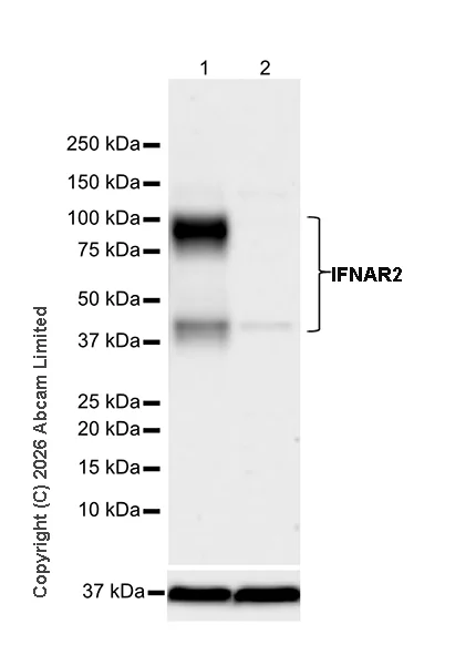 Western blot - Anti-IFNAR2 antibody [EPR30040-606] (AB325344)