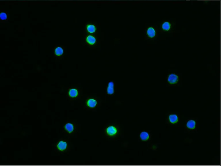Immunocytochemistry - Anti-IFNGR1 antibody [062] - BSA and Azide free (AB277133)