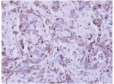 Immunohistochemistry (Formalin/PFA-fixed paraffin-embedded sections) - Anti-IFNGR1 antibody (AB154400)