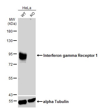 Western blot - Anti-IFNGR1 antibody (AB154400)