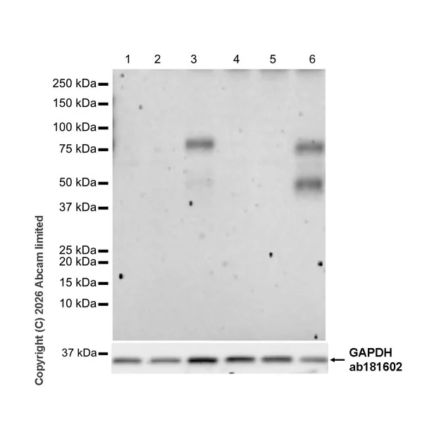 Western blot - Anti-IFNGR1 antibody [EPR24127-89] (AB280353)