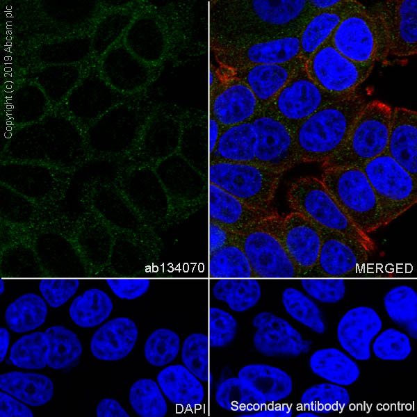Immunocytochemistry/ Immunofluorescence - Anti-IFNGR1 antibody [EPR7866] (AB134070), expandable thumbnail