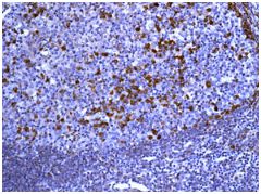 Immunohistochemistry (Formalin/PFA-fixed paraffin-embedded sections) - Anti-IFNGR1 antibody [EPR7866] (AB134070), expandable thumbnail