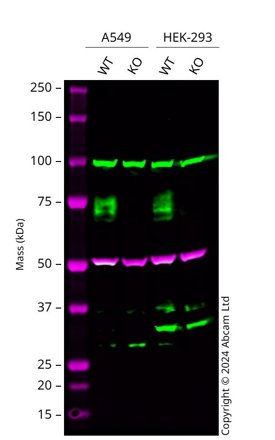 Western blot - Anti-IFNGR1 antibody [EPR7866] (ab134070), expandable thumbnail