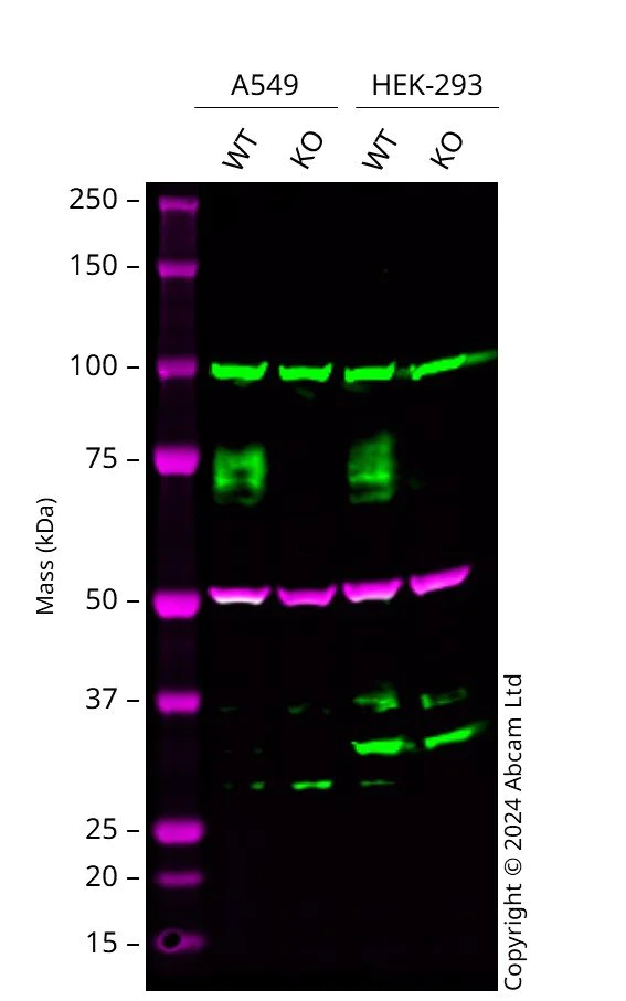 Western blot - Anti-IFNGR1 antibody [EPR7866] - BSA and Azide free (AB226151)