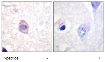 Immunohistochemistry (Formalin/PFA-fixed paraffin-embedded sections) - Anti-IFNGR1 (phospho Y457) antibody (AB61062)
