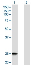 Western blot - Anti-IFNK antibody (AB168119), expandable thumbnail