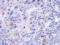 Immunohistochemistry (Formalin/PFA-fixed paraffin-embedded sections) - Anti-IFT122 antibody (AB111838)