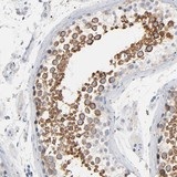 Immunohistochemistry (Formalin/PFA-fixed paraffin-embedded sections) - Anti-IFT43 antibody (AB121195)