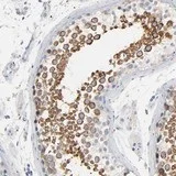 Immunohistochemistry (Formalin/PFA-fixed paraffin-embedded sections) - Anti-IFT43 antibody (AB121195)